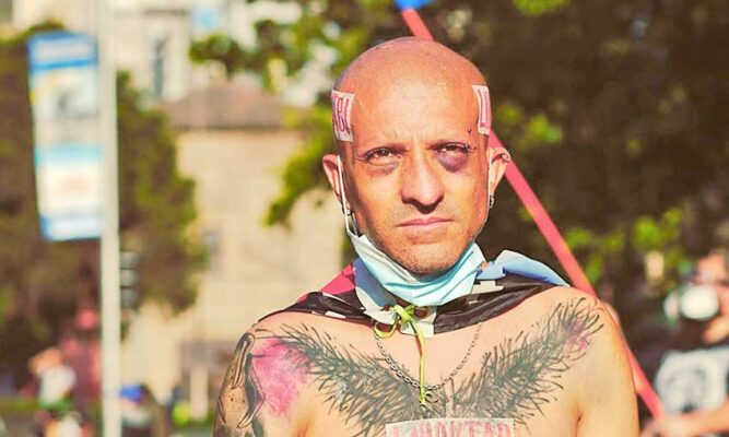 Rojas Vade queda en riesgo vital tras ser encontrado golpeado, maniatado y con mensajes políticos en su cuerpo